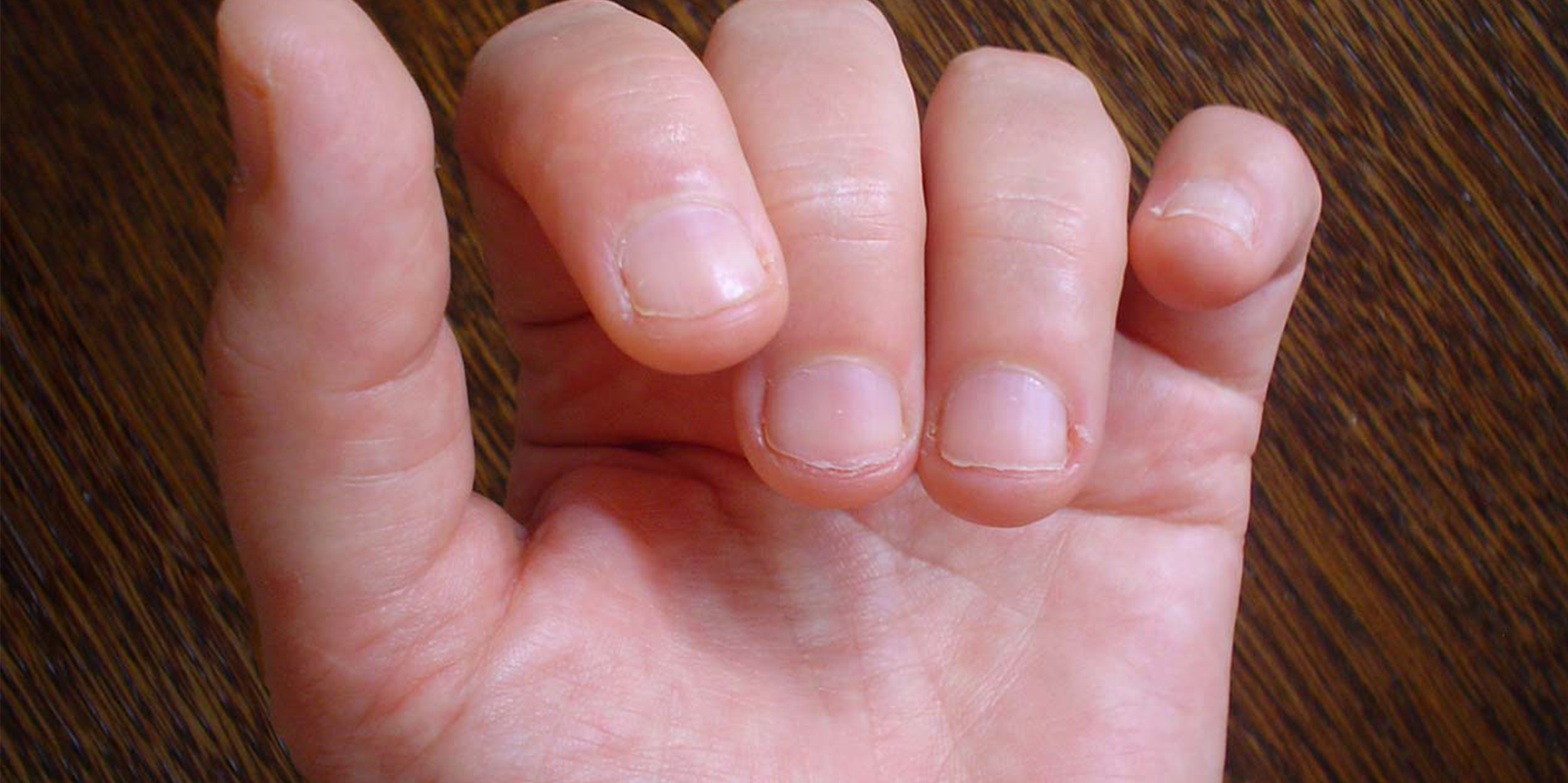 Hand with short nails