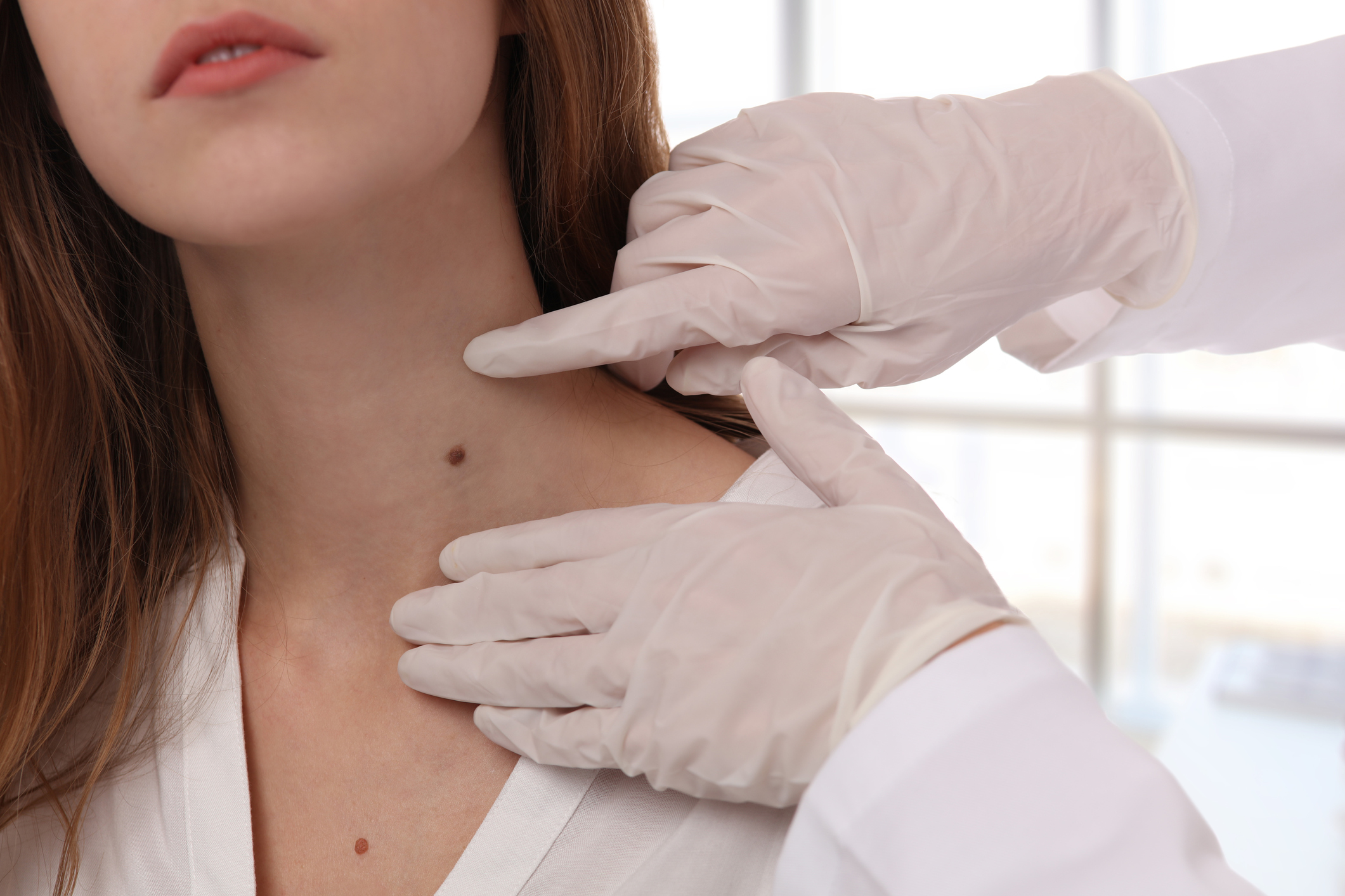 Dermatologist checking patient's mole on neck
