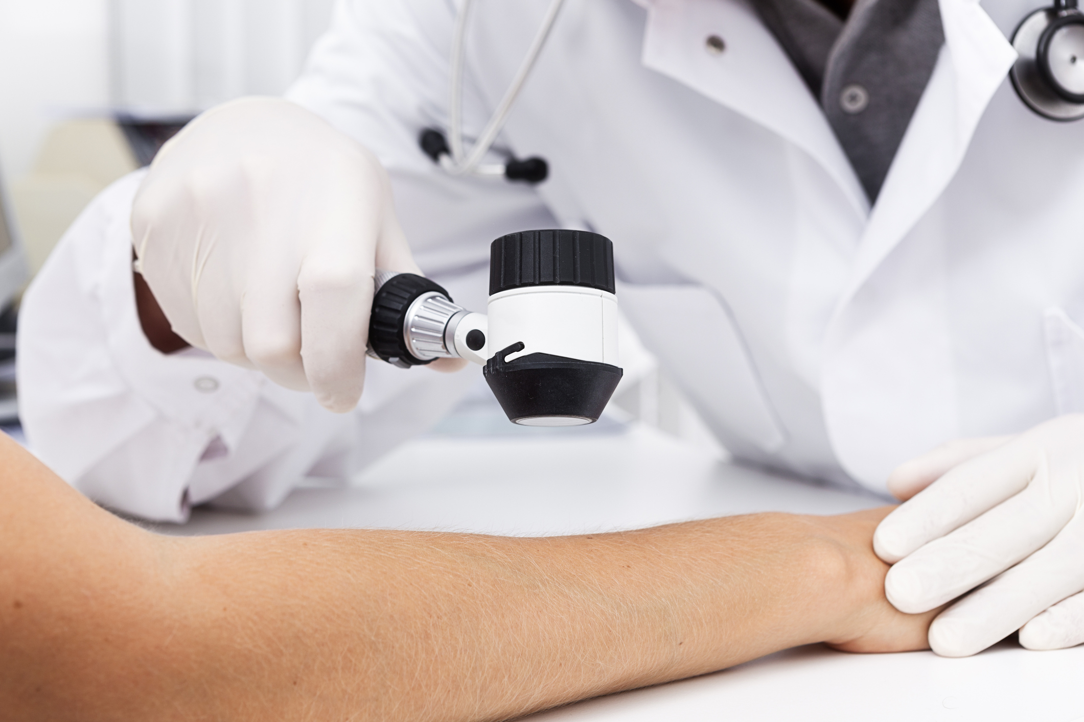 Dermatologist checking the skin on a patient's arm